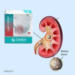 Herbal Stone Breaker Powder Dineh Solvestone