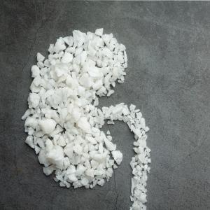 Iranian Urea 46% Prilled – Ready for Bulk Export In Best Price